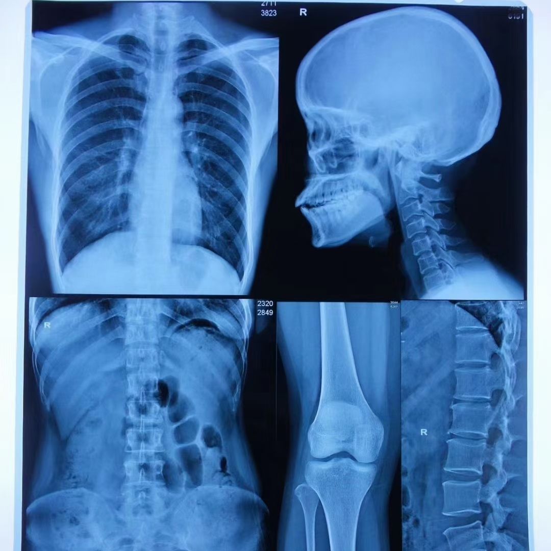 Medical X Ray Dry Thermal Printer Films_medical