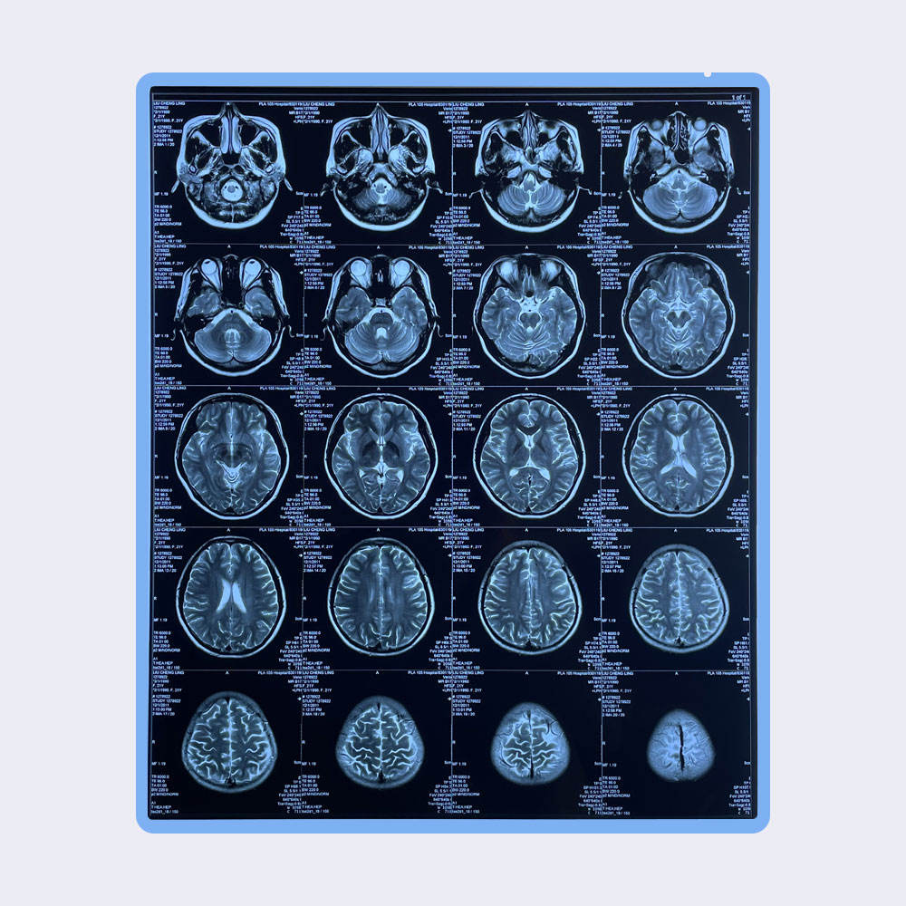 Medical X Ray Dry Thermal Printer Films_medical